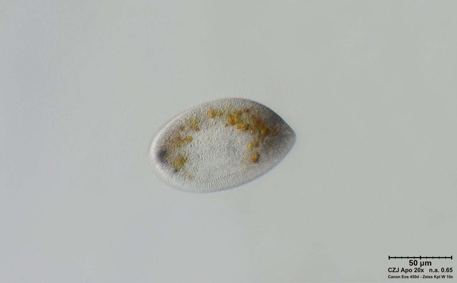 Ciliato da identificare   -  Frontonia acuminata